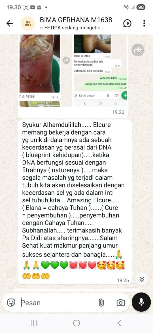 Testimoni pelanggan ELCURE 4