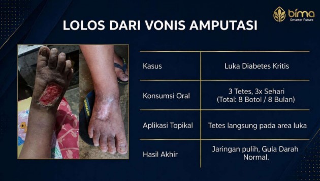 Testimoni pengguna ELCURE 4