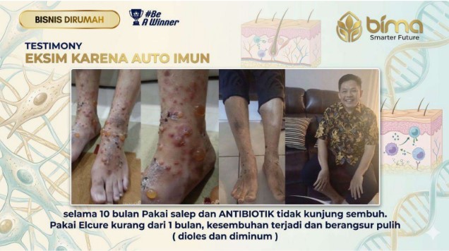 Testimoni pengguna ELCURE 5