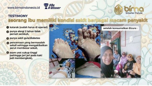 Testimoni pengguna ELCURE 8